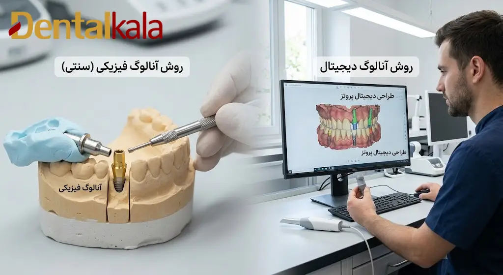 تفاوت آنالوگ دیجیتال با آنالوگ فیزیکی در قالب گیری چیست؟
